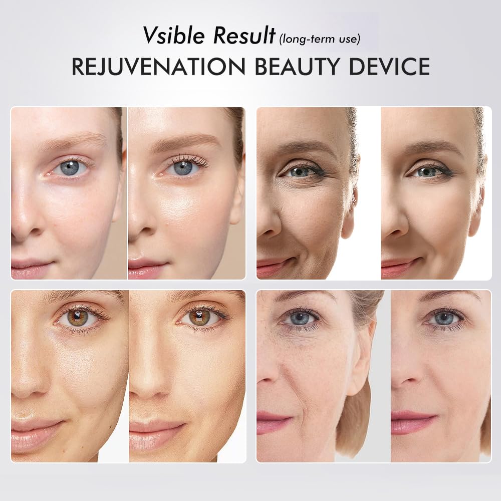 GlowSculpt™ - Multi-Color LED EMS Vibration Face Therapy Device