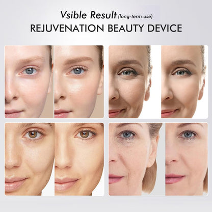 GlowSculpt™ - Multi-Color LED EMS Vibration Face Therapy Device