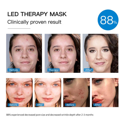 DermaLight™ - LED Red Light Therapy Facial Mask